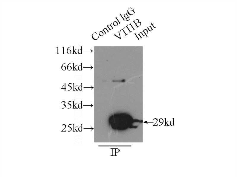IP Result of anti-VTI1B (IP:Catalog No:116808, 3ug; Detection:Catalog No:116808 1:1000) with HeLa cells lysate 2500ug.