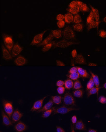 Immunofluorescence - SLC16A4 Polyclonal Antibody 