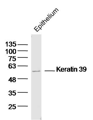 Fig1: Sample:Epithelium(Mouse)Lysate at 40 ug; Primary: Anti-Keratin 39 at 1/300 dilution; Secondary: IRDye800CW Goat Anti-Rabbit IgG at 1/20000 dilution; Predicted band size: 56 kD; Observed band size: 56 kD