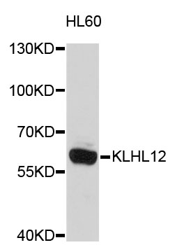 Western blot - KLHL12 Polyclonal Antibody 