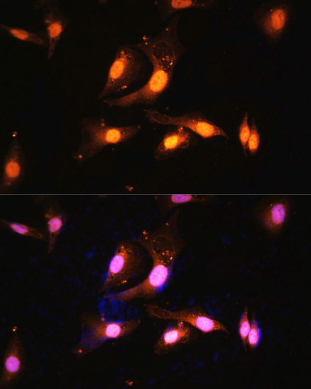 Immunofluorescence - FLCN Polyclonal Antibody 