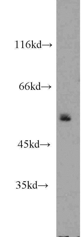 HepG2 cells were subjected to SDS PAGE followed by western blot with Catalog No:113998(POLD2 antibody) at dilution of 1:1000