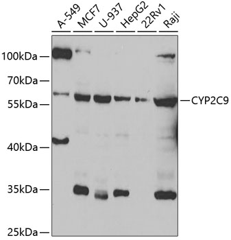 Western blot - CYP2C9 Polyclonal Antibody 