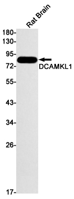 Western blot detection of DCAMKL1 in Rat Brain lysates using DCAMKL1 Rabbit mAb(1:1000 diluted).Predicted band size:82kDa.Observed band size:82kDa.