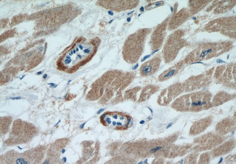 Immunohistochemical of paraffin-embedded human heart using Catalog No:110650(FHL2 antibody) at dilution of 1:50 (under 40x lens)