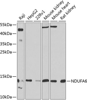 Western blot - NDUFA6 Polyclonal Antibody 