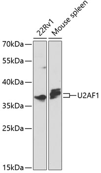 Western blot - U2AF1 Polyclonal Antibody 