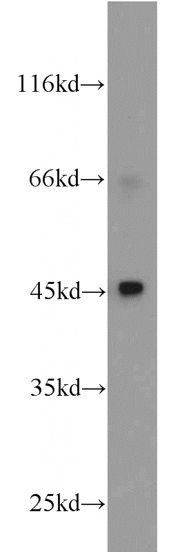 RAW264.7 cells were subjected to SDS PAGE followed by western blot with Catalog No:112646(MAP2K4 antibody) at dilution of 1:600