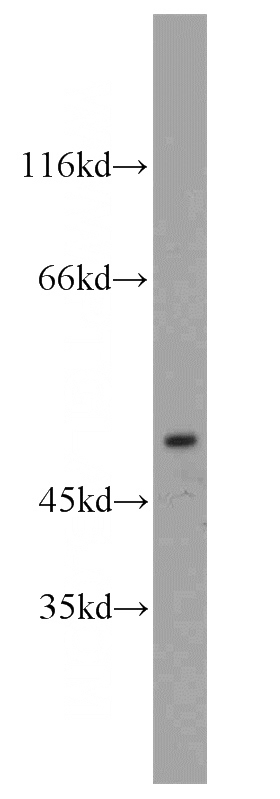 mouse brain tissue were subjected to SDS PAGE followed by western blot with Catalog No:110807(GABRA1 antibody) at dilution of 1:1000
