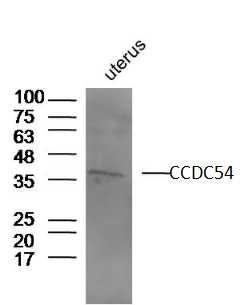 Fig1: Sample:; Uterus (Mouse) Lysate at 40 ug; Primary: Anti-CCDC54 at 1/300 dilution; Secondary: IRDye800CW Goat Anti-Rabbit IgG at 1/20000 dilution; Predicted band size: 36 kD; Observed band size: 36 kD