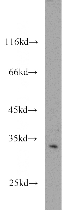 NIH/3T3 cells were subjected to SDS PAGE followed by western blot with Catalog No:109162(CDK5 antibody) at dilution of 1:500