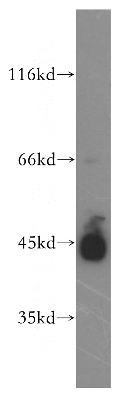 human placenta tissue were subjected to SDS PAGE followed by western blot with Catalog No:117091(B3GNT3 antibody) at dilution of 1:500