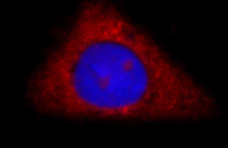 Immunofluorescent analysis of HepG2 cells, using DDX58 antibody Catalog No:109840 at 1:25 dilution and Rhodamine-labeled goat anti-rabbit IgG (red). Blue pseudocolor = DAPI (fluorescent DNA dye).