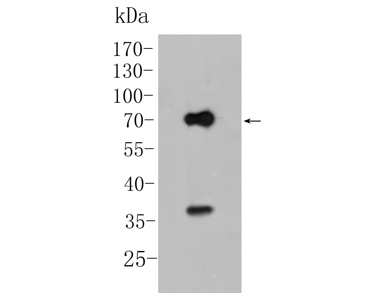 Fig1:; Western blot analysis of KCNN2 on rat brain tissue lysate. Proteins were transferred to a PVDF membrane and blocked with 5% BSA in PBS for 1 hour at room temperature. The primary antibody ( 1/500) was used in 5% BSA at room temperature for 2 hours. Goat Anti-Rabbit IgG - HRP Secondary Antibody (HA1001) at 1:5,000 dilution was used for 1 hour at room temperature.