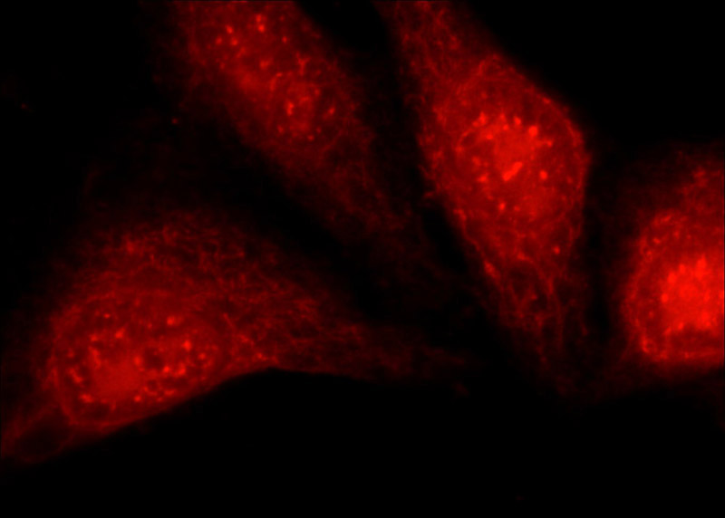 Immunofluorescent analysis of HepG2 cells using Catalog No:113770(PFKFB3 Antibody) at dilution of 1:50 and Rhodamine-Goat anti-Rabbit IgG