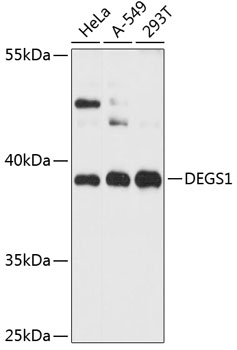 Western blot - DEGS1 Polyclonal Antibody 