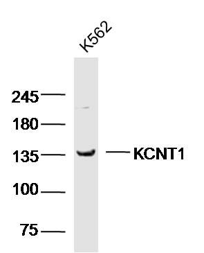 Fig1: Sample: K562 Cell (human) Lysate at 40 ug; Primary: Anti-KCNT1 at 1/300 dilution; Secondary: IRDye800CW Goat Anti-Rabbit IgG at 1/20000 dilution; Predicted band size: 137 kD; Observed band size: 137 kD