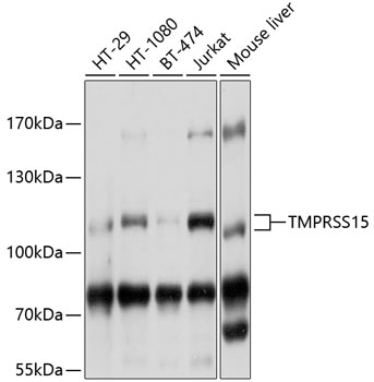 Western blot - TMPRSS15 Polyclonal Antibody 