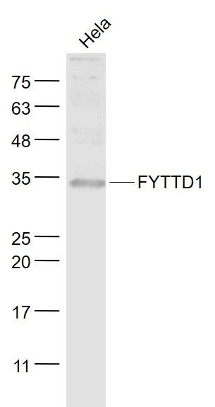 Fig2: Sample:; Hela(Human) Cell Lysate at 30 ug; Primary: Anti- FYTTD1 at 1/1000 dilution; Secondary: IRDye800CW Goat Anti-Rabbit IgG at 1/20000 dilution; Predicted band size: 36 kD; Observed band size: 34 kD
