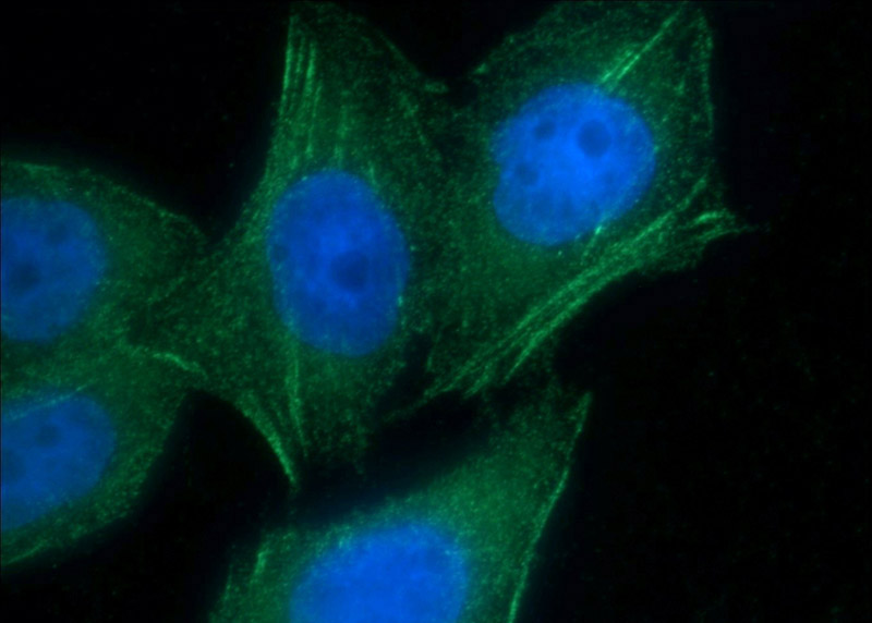 Immunofluorescent analysis of MCF-7 cells using Catalog No:107902(AFAP1 Antibody) at dilution of 1:25 and Alexa Fluor 488-congugated AffiniPure Goat Anti-Rabbit IgG(H+L)