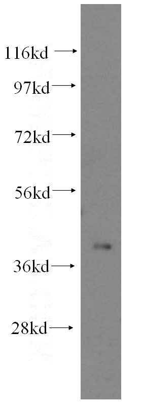 mouse pancreas tissue were subjected to SDS PAGE followed by western blot with Catalog No:115332(SLC25A3 antibody) at dilution of 1:500