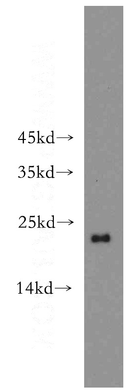 HeLa cells were subjected to SDS PAGE followed by western blot with Catalog No:108242(ARF1 antibody) at dilution of 1:500
