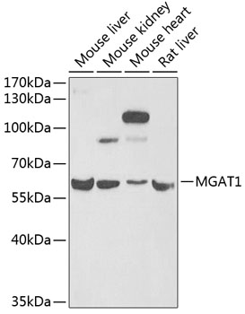 Western blot - MGAT1 Polyclonal Antibody 