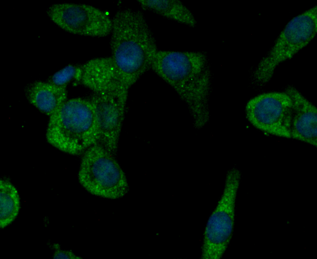 Fig3: ICC staining CACNG5 in LOVO cells (green). The nuclear counter stain is DAPI (blue). Cells were fixed in paraformaldehyde, permeabilised with 0.25% Triton X100/PBS.