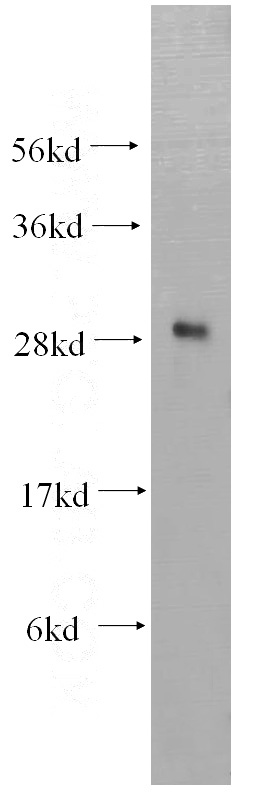 HeLa cells were subjected to SDS PAGE followed by western blot with Catalog No:109232(CHMP1B antibody) at dilution of 1:300