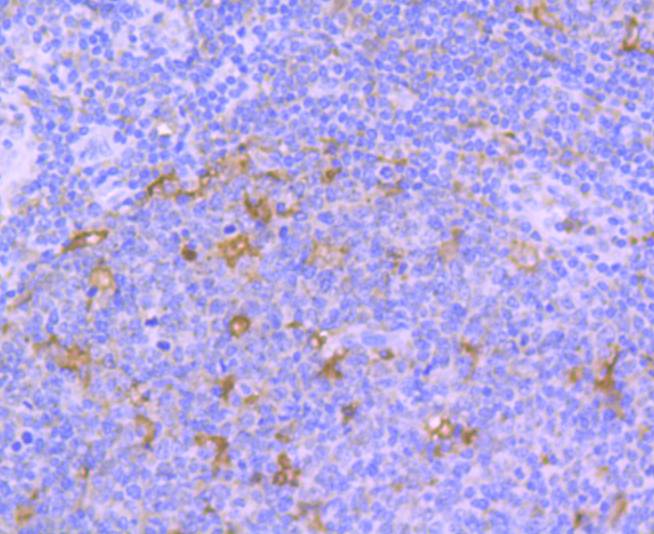 Fig9:; Immunohistochemical analysis of paraffin-embedded human tonsil tissue using anti-TrkA antibody. The section was pre-treated using heat mediated antigen retrieval with Tris-EDTA buffer (pH 9.0) for 20 minutes.The tissues were blocked in 5% BSA for 30 minutes at room temperature, washed with ddH; 2; O and PBS, and then probed with the primary antibody ( 1/50) for 30 minutes at room temperature. The detection was performed using an HRP conjugated compact polymer system. DAB was used as the chromogen. Tissues were counterstained with hematoxylin and mounted with DPX.