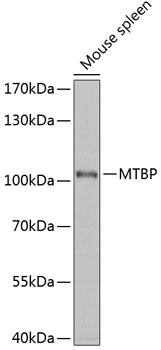 Western blot - MTBP Polyclonal Antibody 