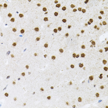 Immunohistochemistry - FAF1 Polyclonal Antibody 