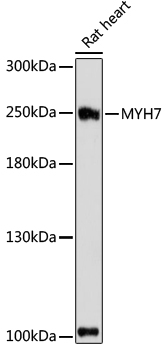 Western blot - MYH7 Polyclonal Antibody 
