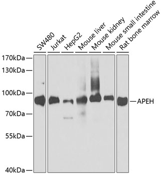 Western blot - APEH Polyclonal Antibody 