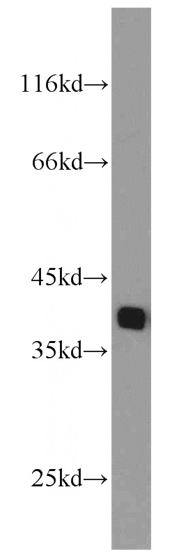 HEK-293 cells were subjected to SDS PAGE followed by western blot with Catalog No:113744(PCNA antibody) at dilution of 1:1000