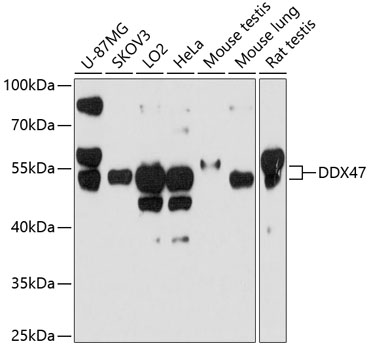 Western blot - DDX47 Polyclonal Antibody 