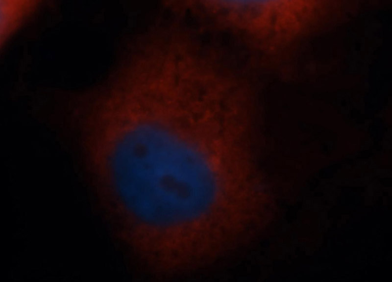 Immunofluorescent analysis of MCF-7 cells, using RPS4X antibody Catalog No:114908 at 1:50 dilution and Rhodamine-labeled goat anti-rabbit IgG (red). Blue pseudocolor = DAPI (fluorescent DNA dye).
