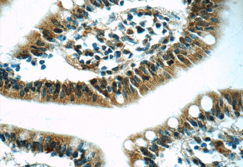 Immunohistochemistry of paraffin-embedded human small intestine tissue slide using Catalog No:114853(RSRC1 Antibody) at dilution of 1:50 (under 40x lens)