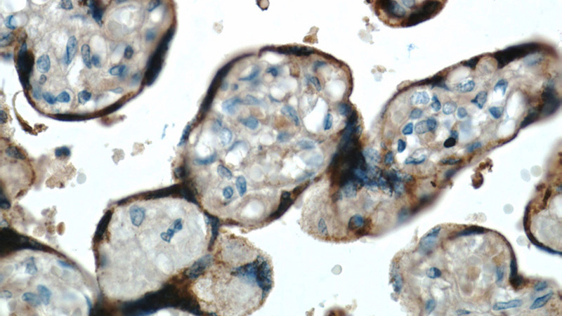 Immunohistochemical of paraffin-embedded human placenta using Catalog No:113932(CSH1 antibody) at dilution of 1:50 (under 40x lens)