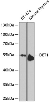Western blot - DET1 Polyclonal Antibody 
