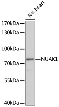 Western blot - NUAK1 Polyclonal Antibody 
