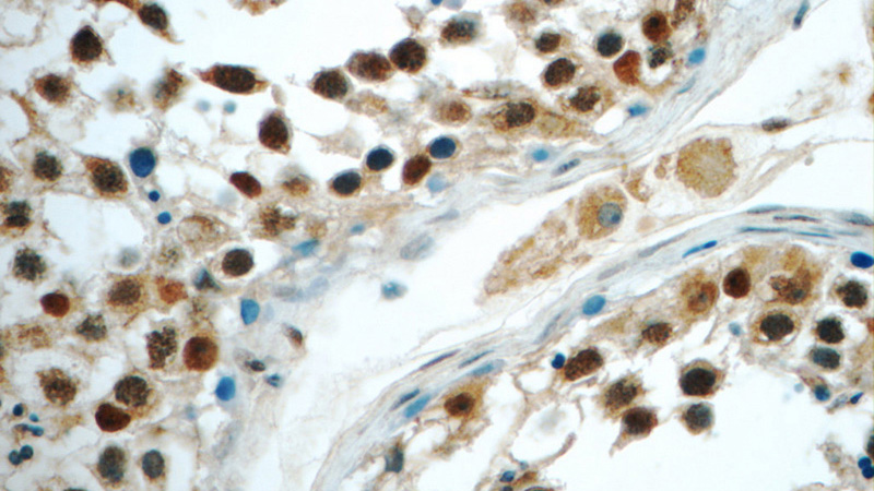 Immunohistochemistry of paraffin-embedded human testis tissue slide using Catalog No:108709(C22orf41 Antibody) at dilution of 1:50 (under 40x lens)