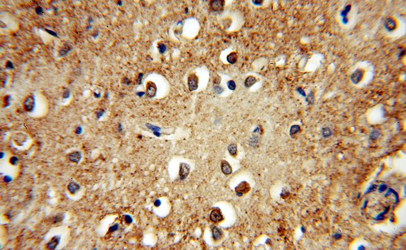 Immunohistochemical of paraffin-embedded human brain using Catalog No:113949(PLCH1 antibody) at dilution of 1:50 (under 40x lens)
