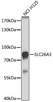 Western blot - SLC26A3 Polyclonal Antibody 