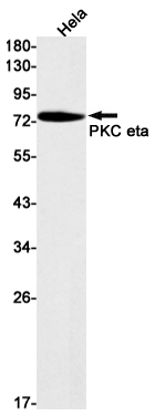 Western blot detection of PKC eta in Hela cell lysates using PKC eta Rabbit mAb(1:1000 diluted).Predicted band size:78kDa.Observed band size:78kDa.