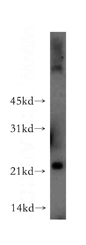 human liver tissue were subjected to SDS PAGE followed by western blot with Catalog No:112944(MYL4 antibody) at dilution of 1:400