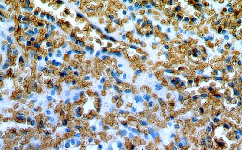 Immunohistochemical of paraffin-embedded human spleen using Catalog No:108417(SLC4A1 antibody) at dilution of 1:50 (under 40x lens)