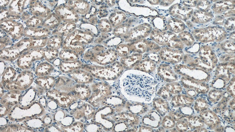 Immunohistochemistry of paraffin-embedded human kidney tissue slide using Catalog No:113357(NUDT16 Antibody) at dilution of 1:50 (under 10x lens)