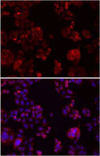 Immunofluorescence - NOTCH3 Polyclonal Antibody 