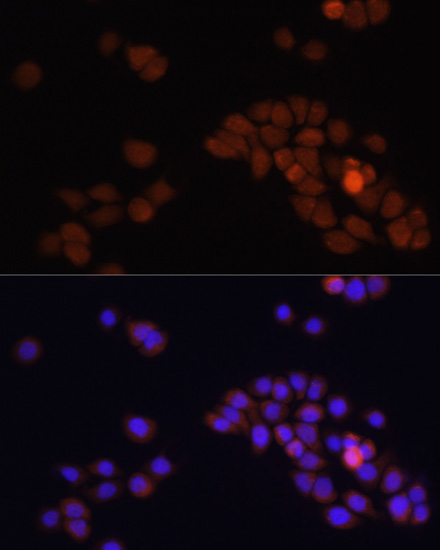 Immunofluorescence - APC Polyclonal Antibody 